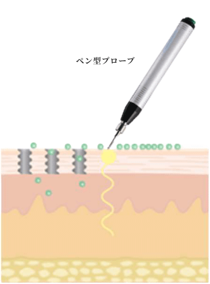 ペン型